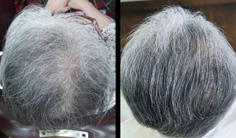 70代女性