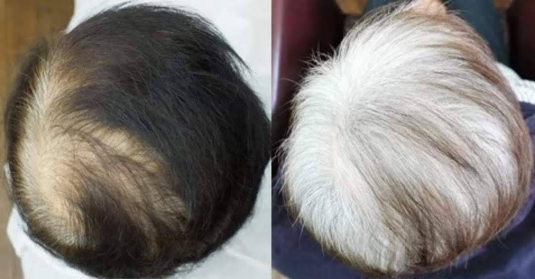 70代女性